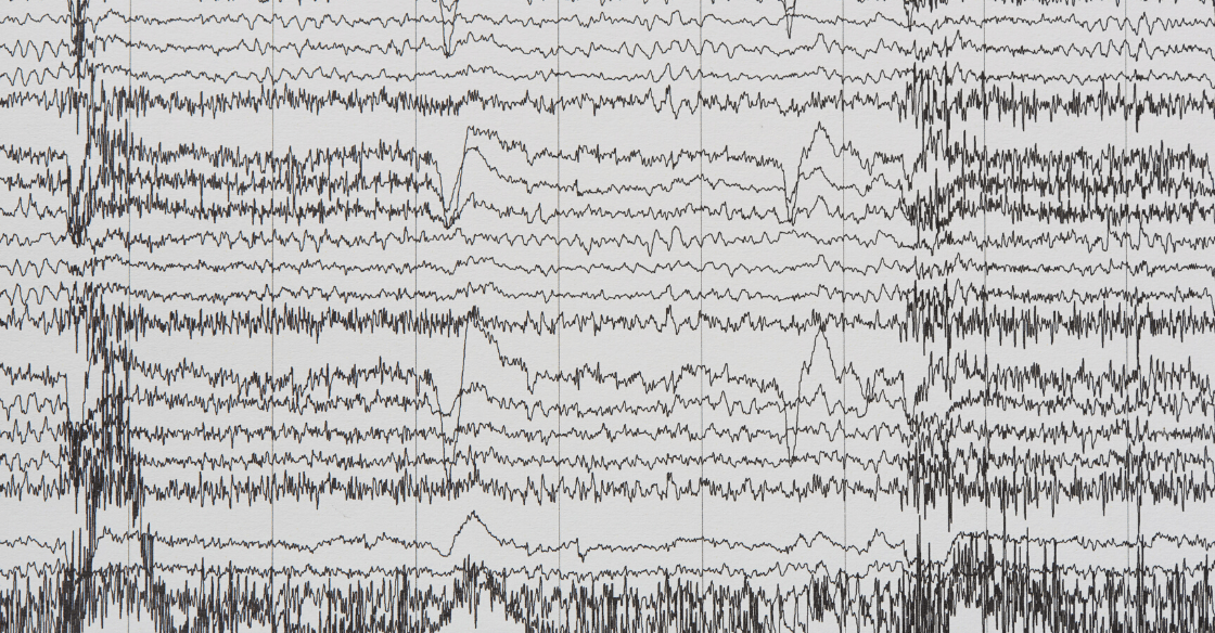 Electroencephalography graphic - Neuromarketing